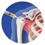 What's new in sports medicine.